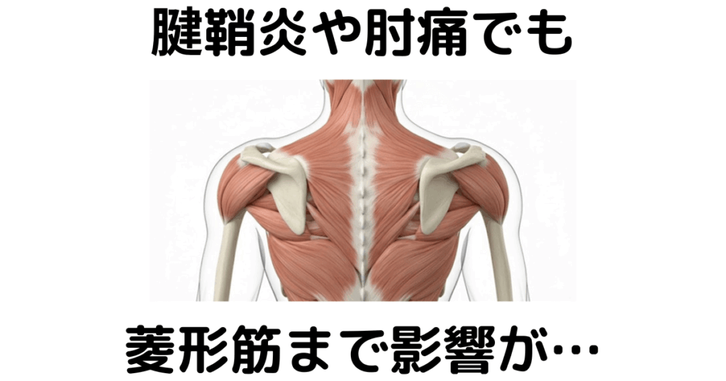 近江八幡市の全身整体つきひ 腱鞘炎・肘痛改善 腱鞘炎や肘痛でも菱形筋まで影響が…