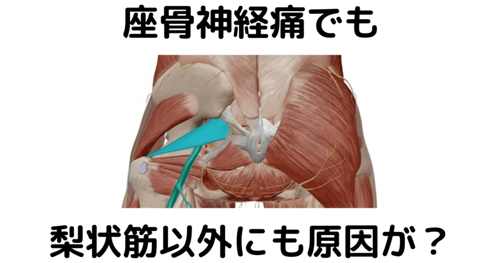 近江八幡市の全身整体つきひ 坐骨神経痛改善 座骨神経痛でも梨状筋以外にも原因が?