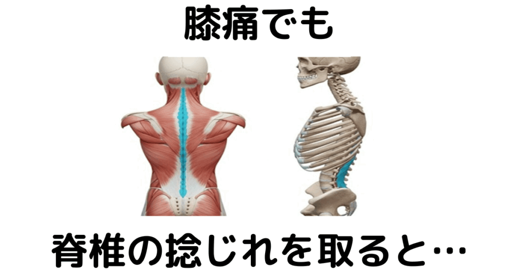 近江八幡市の全身整体つきひ 膝痛改善 膝痛でも脊椎の捻じれを取ると…