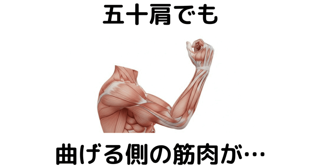 近江八幡市の全身整体つきひ 五十肩改善 五十肩でも曲げる側の筋肉が…