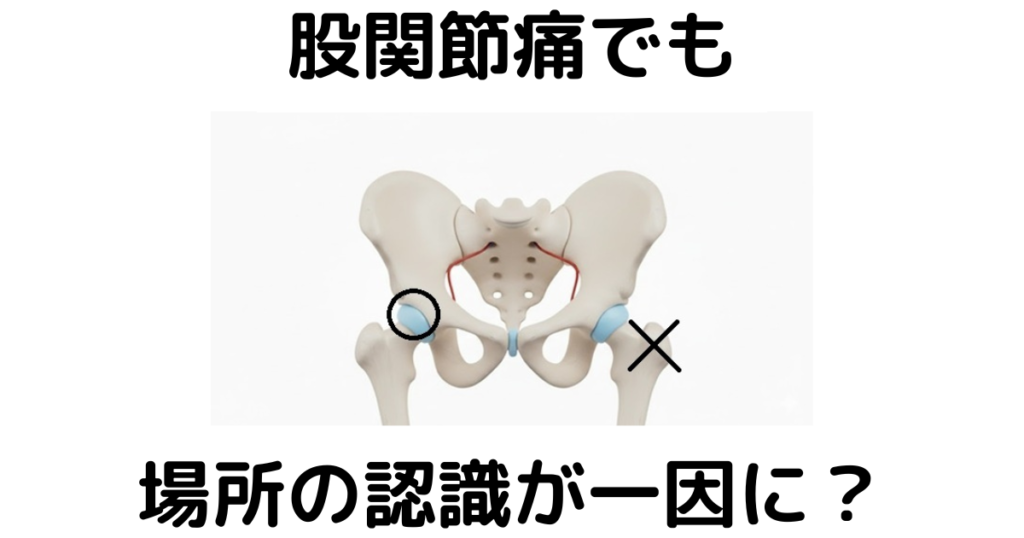 近江八幡市の全身整体つきひ　股関節痛改善　股関節痛でも場所の認識が一因に？