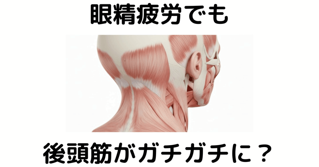 近江八幡市の全身整体つきひ 睡眠改善 眼精疲労でも後頭筋がガチガチに?